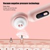 Blackhead Remover Blackhead Absorption Instrument Electric Pore Vacuum Machine Facial