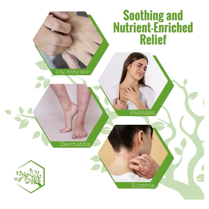 Jabón Corporal Hidratante Para Eccema Y Psoriasis