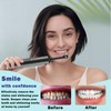 Rechargeable Tooth Polisher with 5 Brush Heads 9 Polish Pastes
