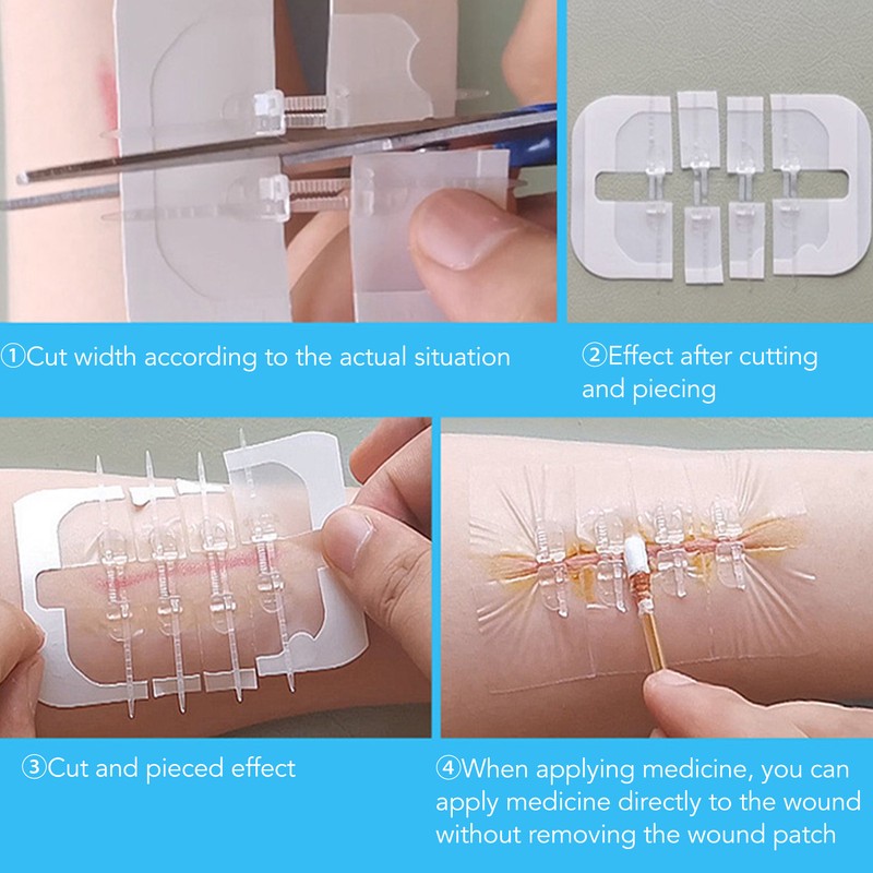 1pcs Emergency Wound Closures Adhesive Seamless Cuttable Hygienic Zip Stitch