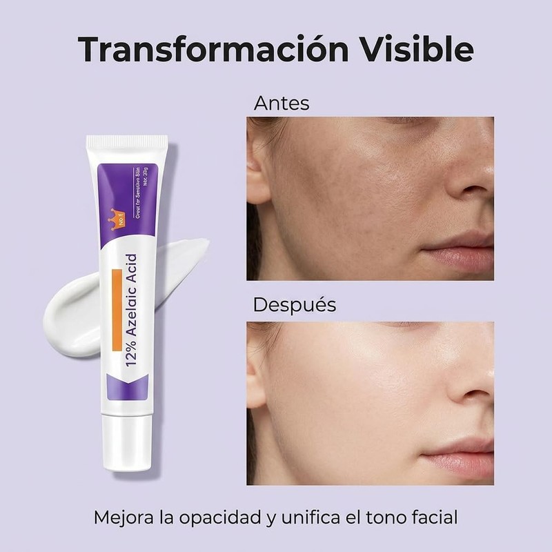Crema Ácido Azelaico, Suero Facial 12%, 2 Piezas, 20g*2