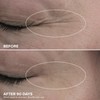 DRMTLGY HPR Eye Cream - Retinoid Under Eye Cream for