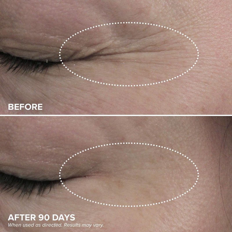 DRMTLGY HPR Eye Cream - Retinoid Under Eye Cream for