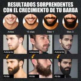 2pcsminoxidil 5biotinacastor Oil Sérum Para Barba                                                                                                     