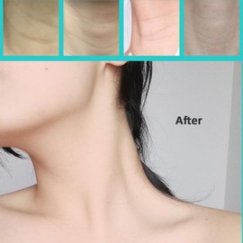 Celestica Neck Lift Tape,Celestica Instant Neck Tape Invisible,Instant Lift&Firming Necks Tapes for Face,Necks&Jaw (Skin color 4 packs + 20 patches, 1)
