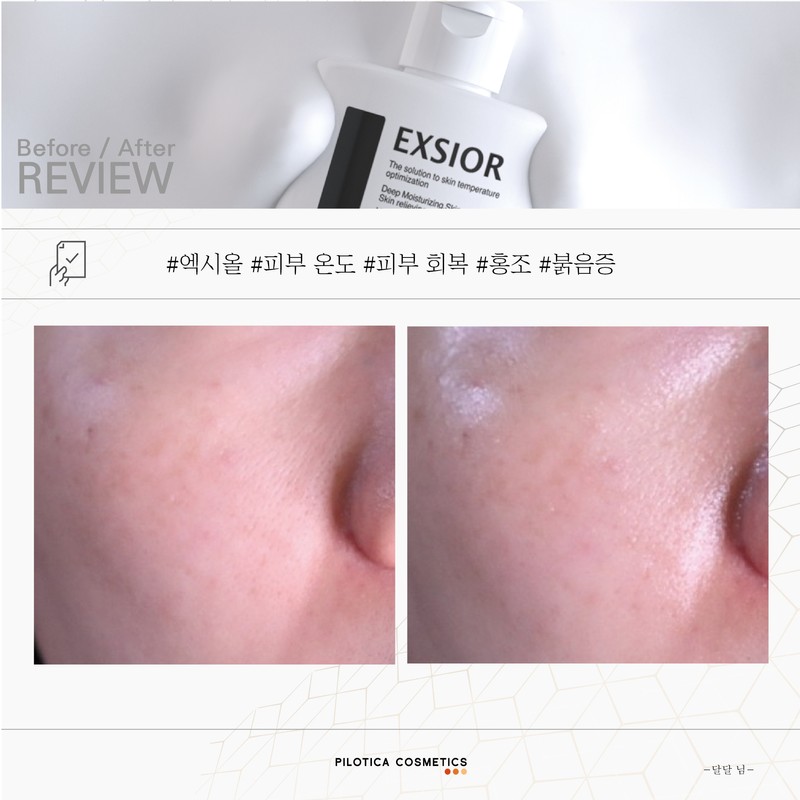 Philotica Exiol Water Glow Soothing Skin Temperature Serum 80ml, 1
