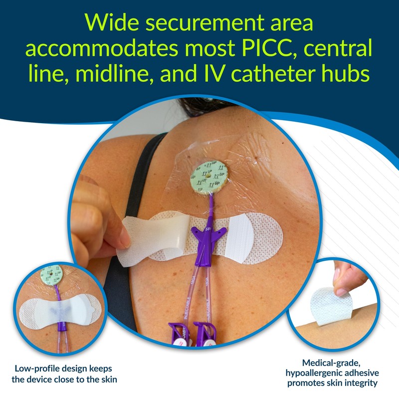 TIDI 3300MWA-10PK Grip-Lok Medium-Wide CVC, PICC & Drain Securement Device