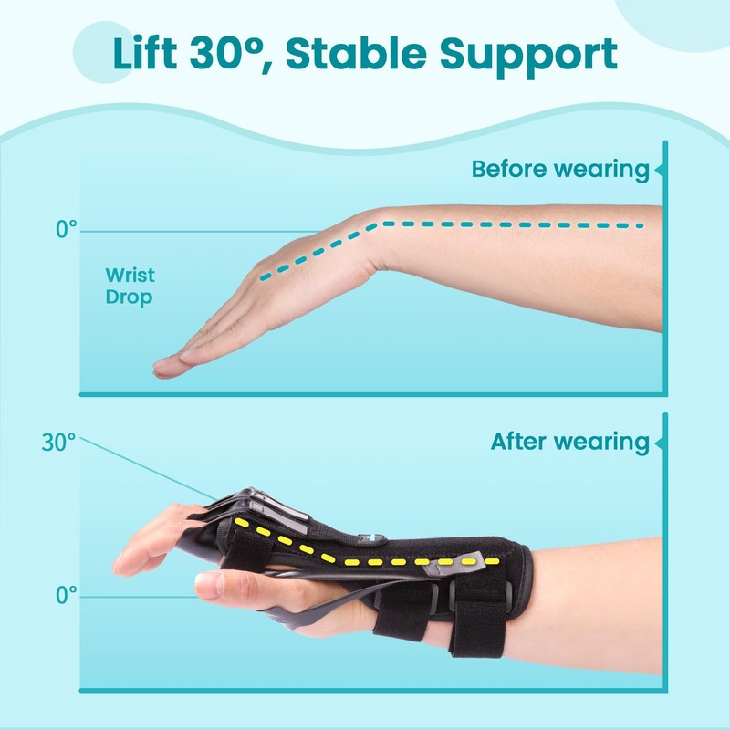 Radial Nerve Palsy Splint Brace for Wrist drop, 5 Fingers