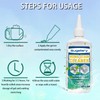 Sugelary Mold Stain Cleaner, 10 Fl oz All-Purpose Gel for