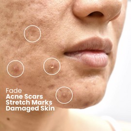 Bioactive Snail Repair Serum Hydrating, Anti-Aging Collagen Boosting Glowing UK