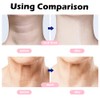 IVEOPPE Face Massager - 4 Modes Face Lifting Device, 45°C