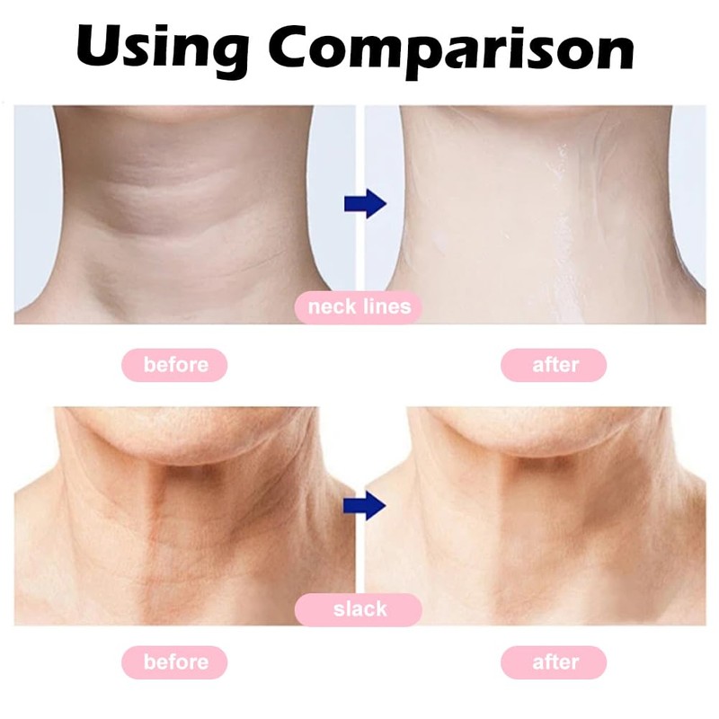 IVEOPPE Face Massager - 4 Modes Face Lifting Device, 45°C
