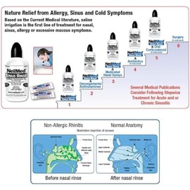 NeilMed Sinus Rinse Premixed Refill Packets – 100 Count (1 Pack) – All Natural Nasal Irrigation Relief for Sinus Congestion, Allergies, Cold, Dryness & Nasal Irritants – Drug-Free & Preservative-Free