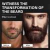 2xcontiene De Biotina Suero Para Crecimiento De La Barba 20%
