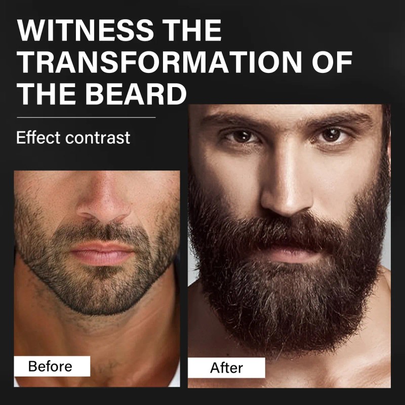 2xcontiene De Biotina Suero Para Crecimiento De La Barba 20%