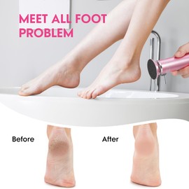 Upgraded Electric Foot Callus Remover, Adjustable Speed Feet File, Feet Callus Remover Kit with 60 Sandpaper Discs for Man Women Dead Skin, Hard Cracked Skin, Dry Skin, Ideal Gift(Pink)