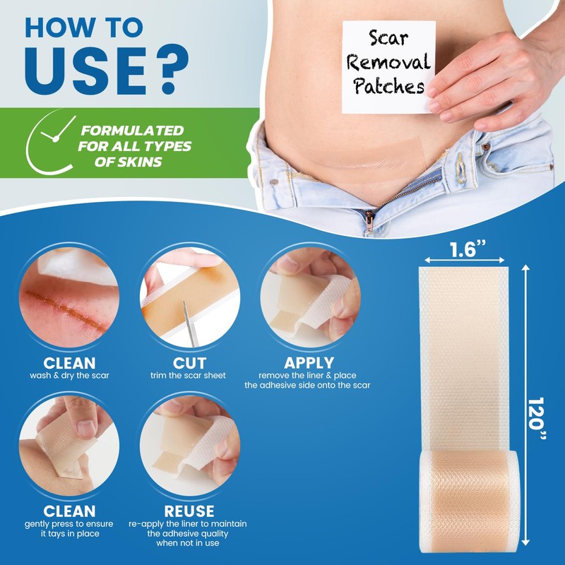 Silicone Scar Sheets,Silicone Scar Tape, (1.6” x 60” Roll, 1.5M)