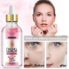 Suero Facial 4 En 1 Ácido Hialurónico Vitamina C Y