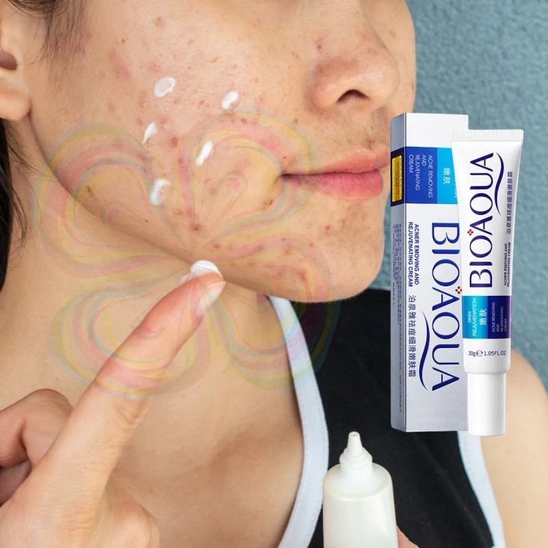 Crema Cicatrices Poros Control De Grasa Acne Cream 2pz Full