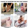 1 Piece Big Toe Training Band Hallux Valgus Band Corrector
