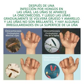 3pc Suero Uñas Jengibre 7 Días Cuidado Reparador De Uñas