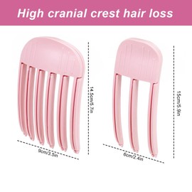 HQRKOTM Volume Clips Hair, Volume Clip for Hairline, 2 x Hair Volume Hair Clip - Fixed Forehead Hair Pin for Long and Short Hair, Traceless Hair Clip, Hair Styling Tools (Light Pink)