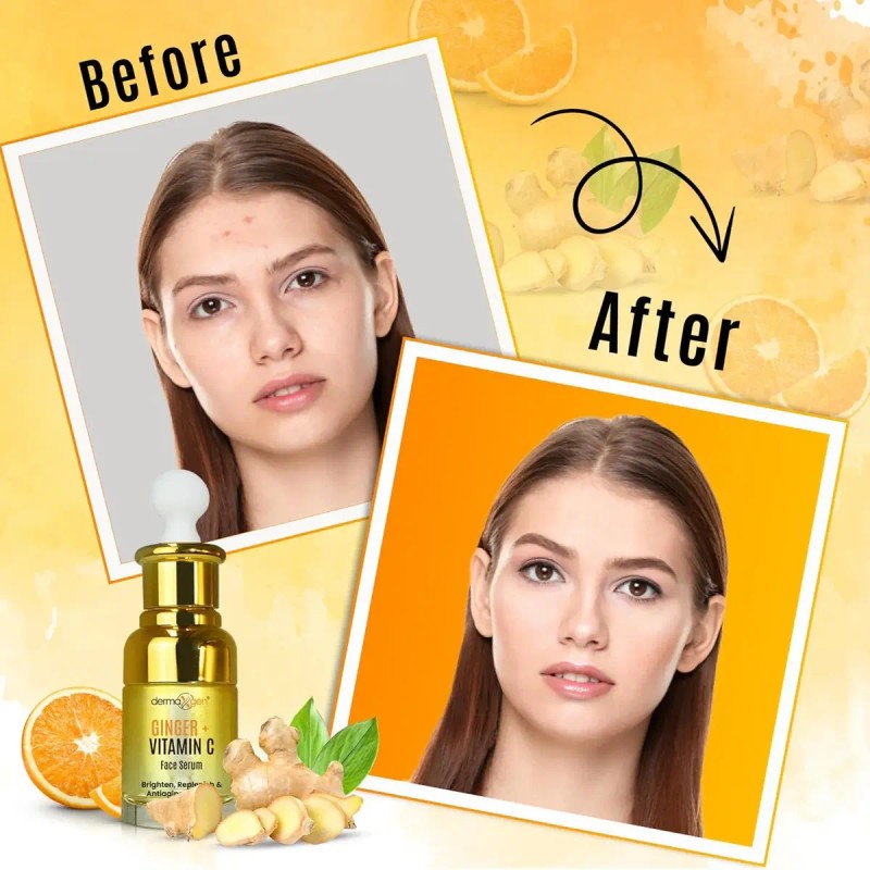 Suero Facial De Jengibre + Vitamina C + Cúrcuma, Tratamiento