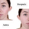 Kit Purificante Acné Lilo Skincare Niacinamida Y Retinol