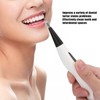 Electric Dental Calculus Remover Portable Oral Calculus Remover Teeth Cleaning
