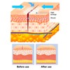 3 Pcs Wound Closure Strip Stitchless Self Adhesive Non Woven