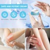 Antifungal Cream, Fast Soothing Itchy, Gentle and Safe (2 Pack)