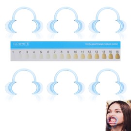 KEPYATI 6 Shape Mouth Opener Dental Mouth Opener Toy for Speak Out Game