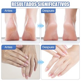 Urea Pies, Crema con Urea para Pies ,Crema para Talones Agrietados ,Crema Hidratante Para Pies, Crema Hidratante Para Pies Con Urea 60, Exfoliante E H