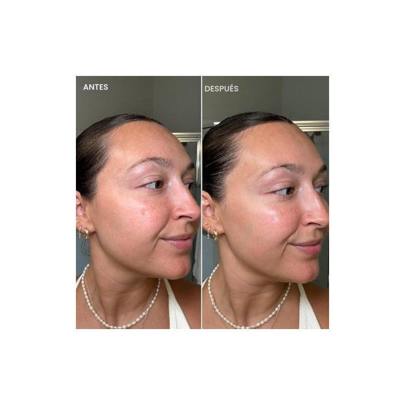 DERMISA CREMA PARA MANCHAS CON VITAMINA C Y EXTRACTO DE