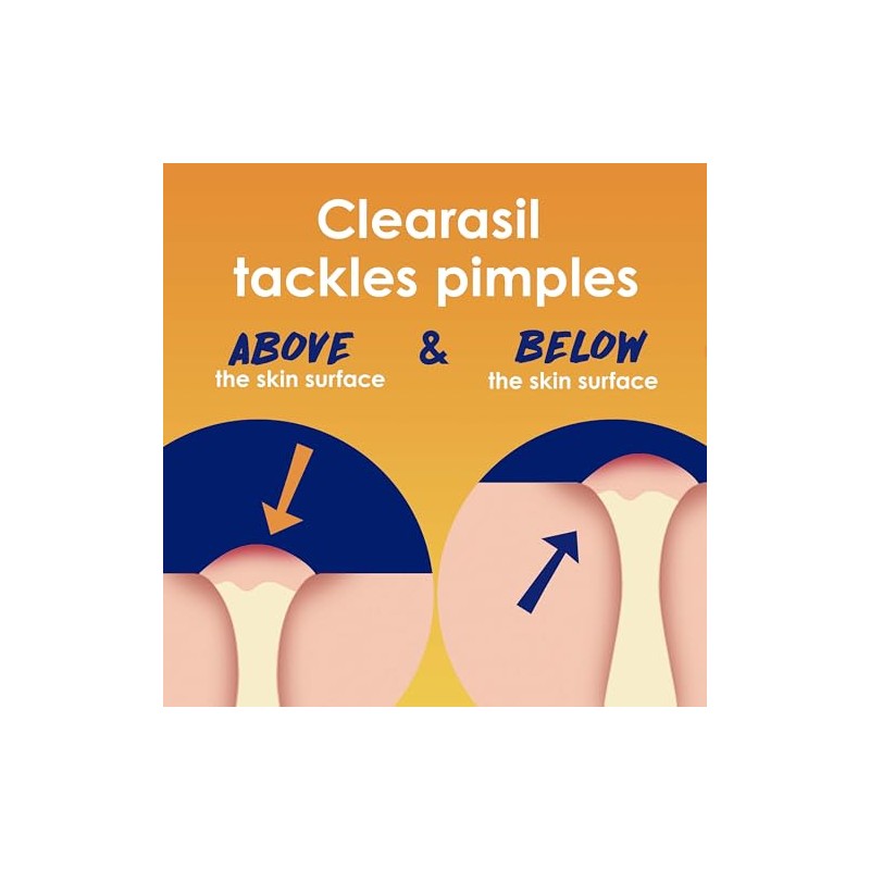 Clearasil Clearasil ultra - 5in1 exfoliating wash, 6.78 Ounce