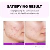 Farmskin Superfood For Skin Hyalusteen Repair Emulsion - Loc