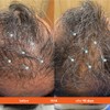 Revita Stimulating Shampoo