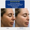 KARECO CE Defense Serum 30 ml. Vitamina C + Ácido