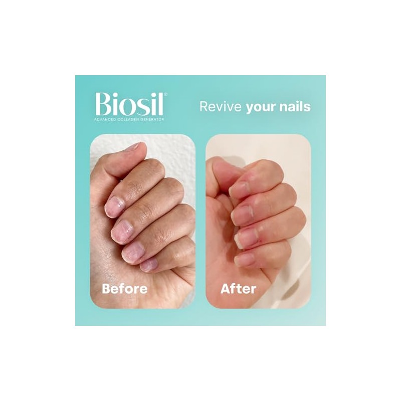 Biosil Collagen Generator - 60 Capsules