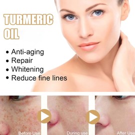 Turmeric Serum, Turmeric Oil, Turmeric Dark Spot Corrector Serum for Face and Body, Skin Care - 30ml (2PCS)
