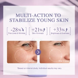 Lupure Bakuchiol Serum for Face – Natural Retinol Alternative for Wrinkles, Fine Lines, Firming, Brightening, Hydrating, Soothing, Anti-Aging & Sensitive Skin Care, with Matrixyl 3000 & Niacinamide
