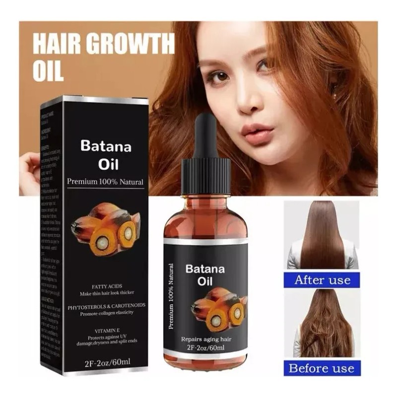 Aceite De Batana De 60ml*3 Para El Crecimiento Del Cabello