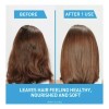 Cerave Hydrating Anti-dandruff Shampoo, All Hair Types, 12oz