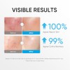 Skintific Crema Hidratante Facial con Ceramidas 5X, 100 G