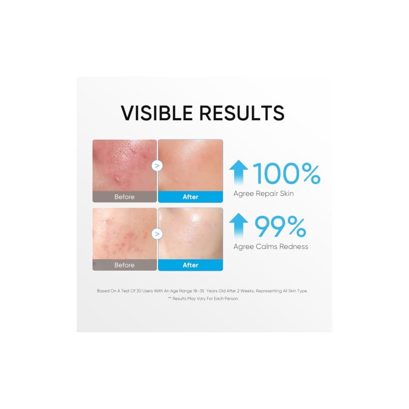 Skintific Crema Hidratante Facial con Ceramidas 5X, 100 G