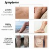 Varicose Veins Cream, Spider Vein Removal, Gentle Leg Care, Improves