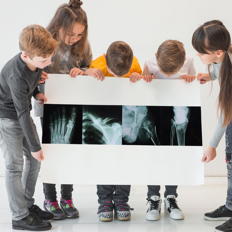 16Pcs Realistic Broken Bones X-Ray (9.8"x9.8") Skeleton X-Rays Human Skeleton