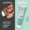 Australian Bodycare Whitening Toothpaste ?C Fights Yellow Stains from Coffee,