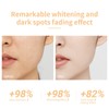 Niacinamide Toner Moisturizing Brightening Whitening Hydrating Improve Dullness Niacinamide Toner