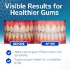 Vitis Gingival Collut 500ml